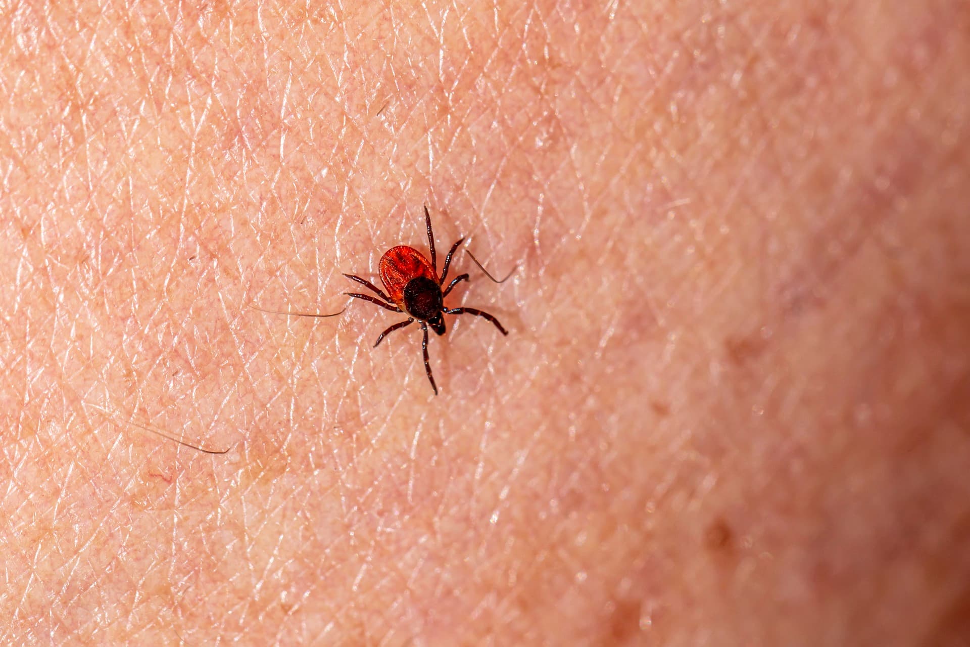 When Climate Gets Under Your Skin